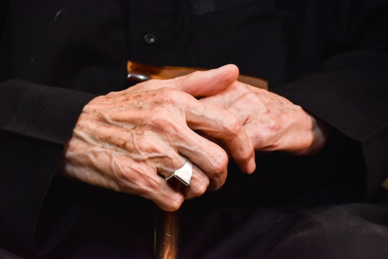 Elderly hands showing signs of arthritis