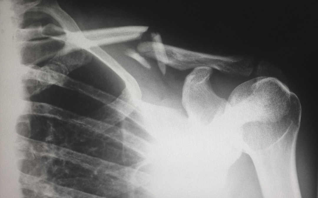 Person with arm in a sling recovering from shoulder surgery